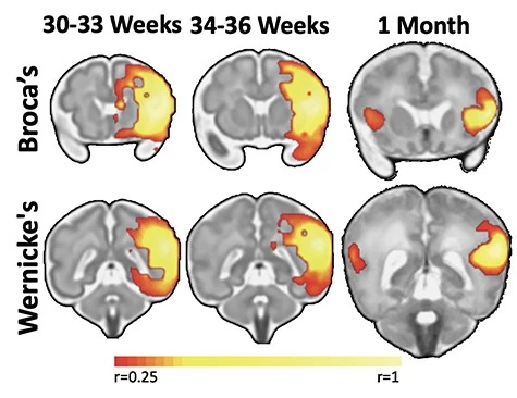 The development of connections between Broca's area and Wernicke's area in the third trimester and the first month of life. Scientific work 
