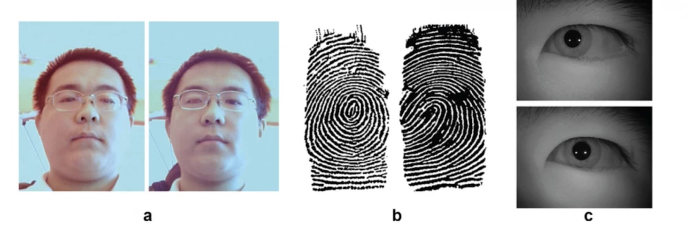 Example of comparison, monozygotic twins