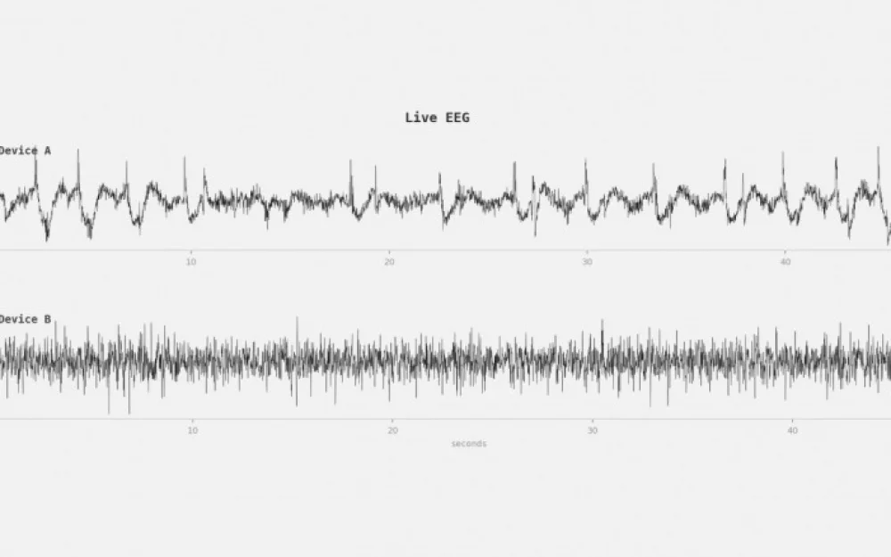 Smart Sleep Mask Exposes Brain Activity Data