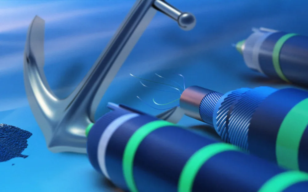 
Not a single break, but this is not certain. Damage to internet backbones at the end of 2024